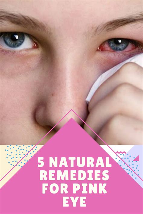 5 Natural Remedies for Pink Eye - Health & Fitness