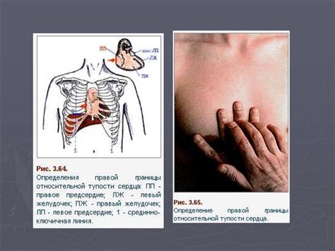 Роль осмотра, поверхностной пальпации и перкуссии в диагностике ...