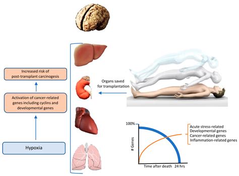 IJMS | Free Full-Text | Induced Coma, Death, and Organ Transplantation
