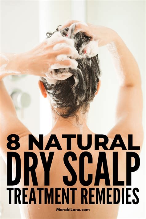 natural dry scalp treatment tips  remedies