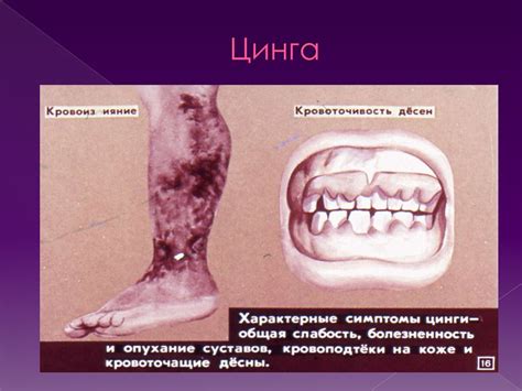 Моногенные болезни - презентация онлайн