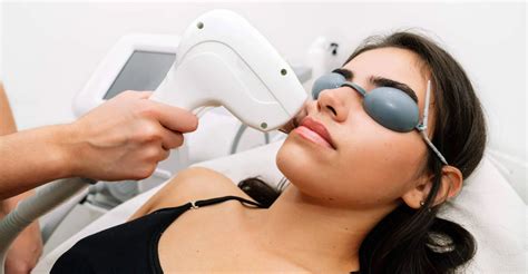 Depilação A Laser Do Buço - Depilacao A Laser Labios Brasileiros Depilação A Laser Ice Laser
