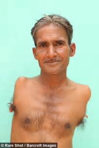 Man Without Arms - Who Is Now A Professional Tailor - Has Opened Up ...