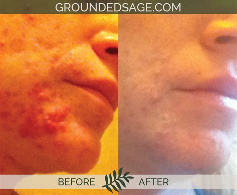 InfluencerGoneWild's Radical Before & After: A Story Of Perseverance Image 3