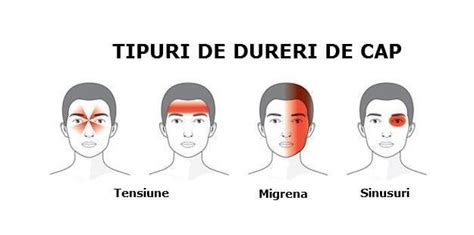 Durerea de cap: cauze, simptome, clasificare și remedii
