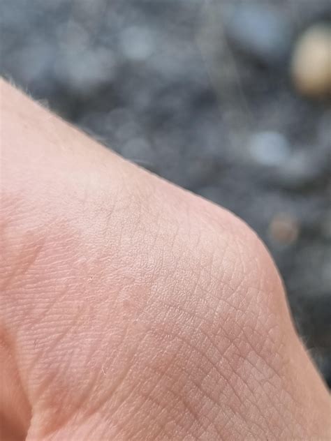 Is it Esophageal Spasms? An Arrythmia? PVCs? : r/GERD