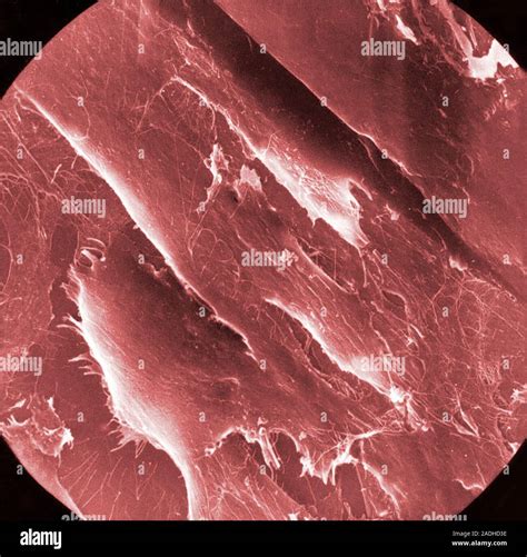 cancer research image    normal cells scanning electron