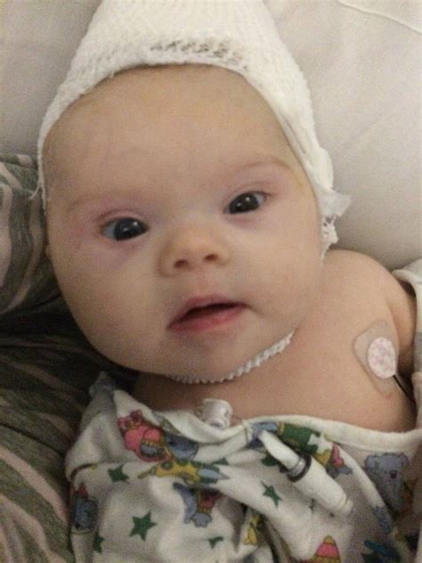 Bambina nata con un tumore inoperabile per i medici è guarita