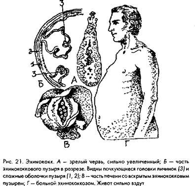 Эхинококк — Студопедия