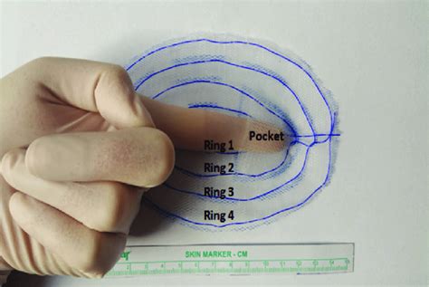 single layer mesh   mip repair  scientific diagram