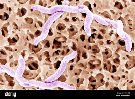 CAMPYLOBACTER JEJUNI Stock Photo - Alamy