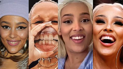 Doja Cat's Teeth Before and After Veneers + SERIOUSLY Bad Dental ...
