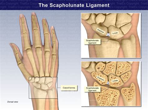 The Scapholunate Ligament - TrialExhibits Inc.