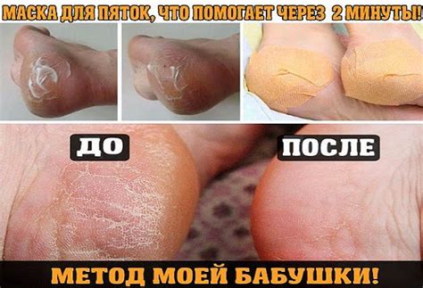 Секреты красоты и здоровья.: Маски для гладких пяток.