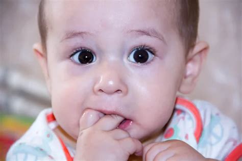 Infant with allergic diathesis — Stock Photo © AChubykin #3475549