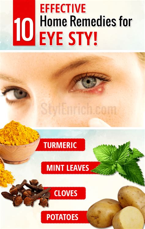 Home Remedies For Eye Stye : The Effective Treatments for Eye Stye