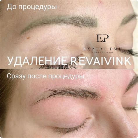 Ремувер для удаления татуажа бровей губ и век