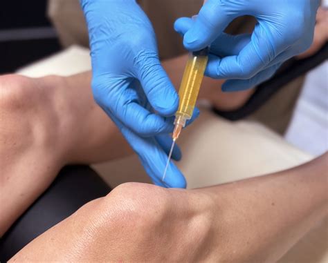 How Many PRP Injections Are Needed For Knee? - Legacy Clinic of ...