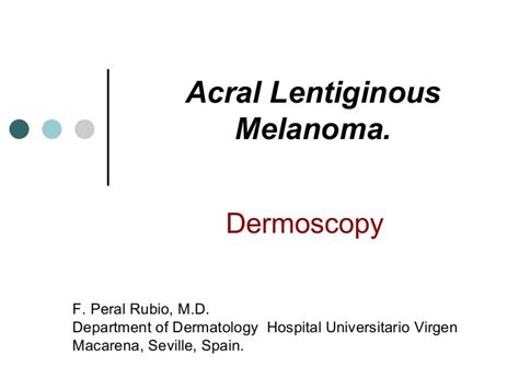 Acral lentiginous melanoma