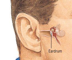 Ruptured Ear Drum Symptoms