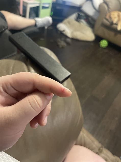 Cut my finger at work. I produce meat. : r/InjuriesAndWounds