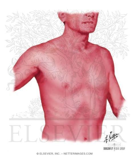 vancomycin treatment difficulties resistance  adverse effects