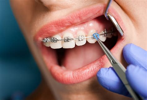 how much does it cost to become an orthodontist