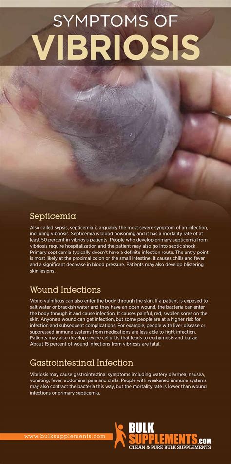 Vibriosis: What You Need to Know to Protect Yourself