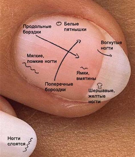 Бороздки на ногтях рук (62 фото)