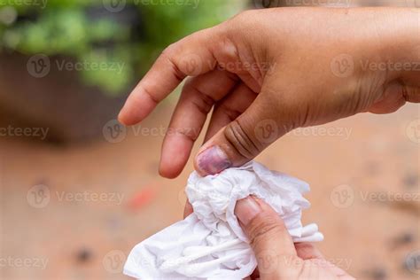 Injury to the right hand nail and bleeding to the right thumb And