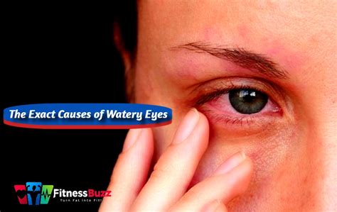 Exact Causes of Watery Eyes 2023: How to Treat Watery Eyes?