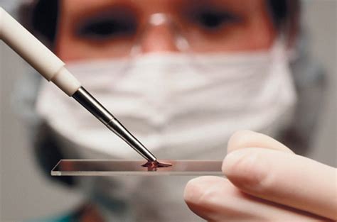 8 храни, които разреждат кръвта и действат по- добре от аспирин даже ...