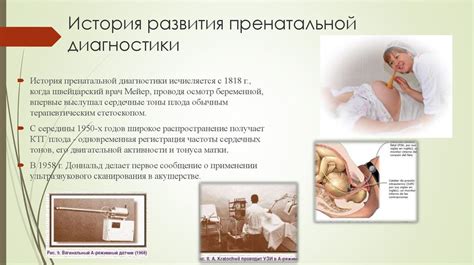 Современные методы пренатальной диагностики - презентация онлайн