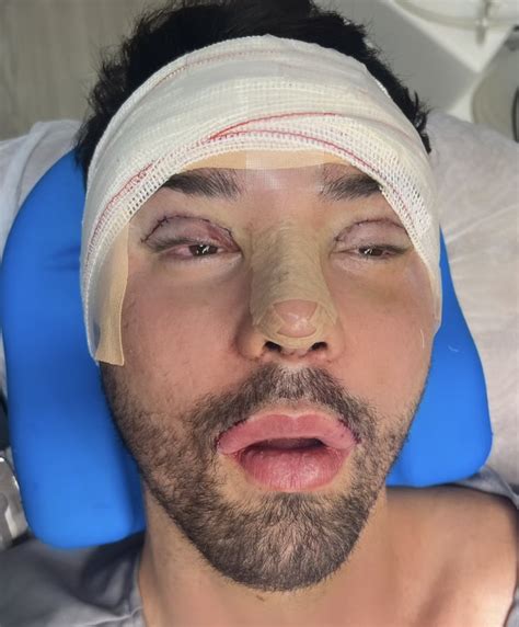 rico tem atitude desesperadora apos ser chamado de feio