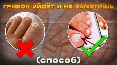 НЕУМЫВАКИН: Все грибки, вирусы и бактерии уйдут вместе с болезнями! От ...