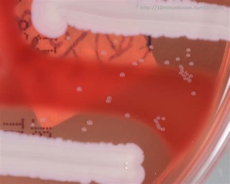 MICROCOSM | Corynebacterium kroppenstedtii