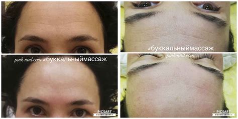 Буккальный массаж лица | Цены в Минске | Омоложение кожи