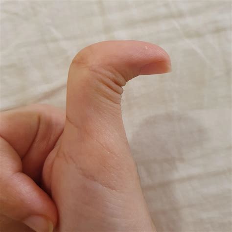 My thumb bend back at a right angle.. : r/mildlyinteresting
