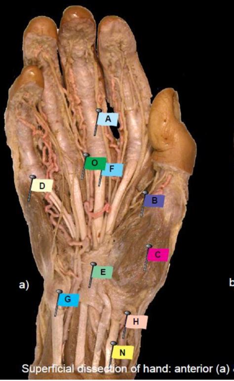 palmar hand diagram quizlet