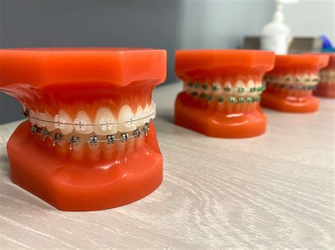 Reynolds Orthodontics | Indian Land SC