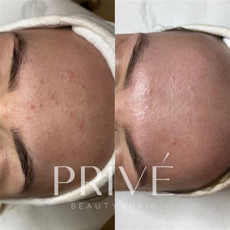 PCA SKIN - Prive Beauty & Hair