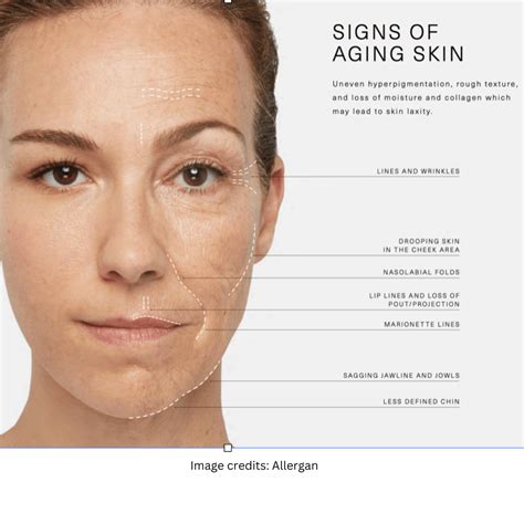 understanding  anatomy  facial aging improves natural results