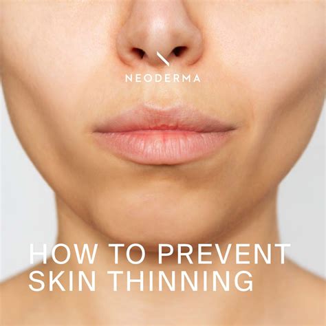 prevent skin thinning neoderma