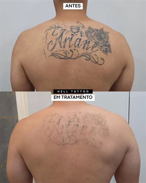 É Normal A Tatuagem Desbota Na Cicatrização - Cicatrização da Tatuagem: Conheça as três fases e o que pode ocorrer