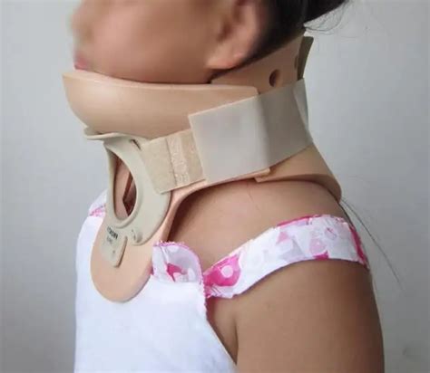 Fractures of the cervical vertebrae: consequences and treatment | Health