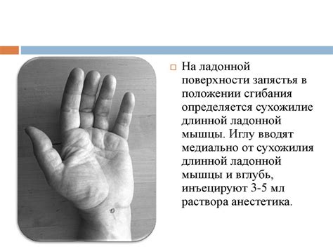 Туннельные синдромы верхней конечности - презентация онлайн