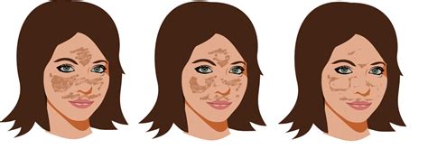 Пигментация на лице, новые схемы и открытия | Дракон старой гвардии | Дзен