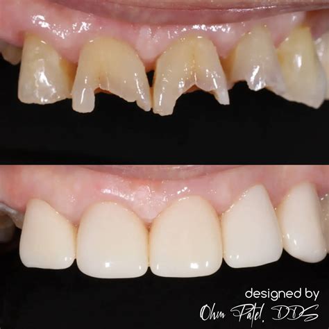 Falls Pointe Dentistry | Trusted Dentist in Raleigh