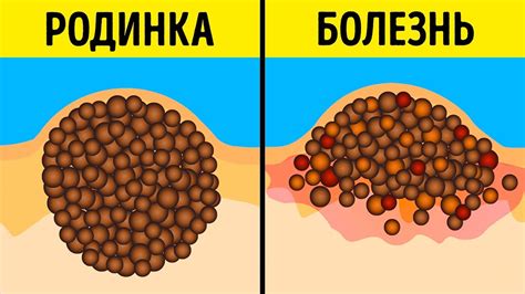 9 Мифов о Родинках и Загаре, в Которые Давно Пора Перестать Верить ...
