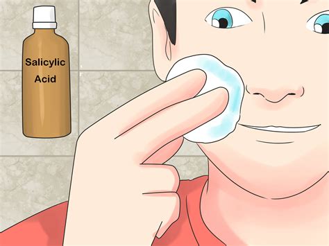 Best Tips About How To Prevent Ingrown Neck Hairs - Matehope54